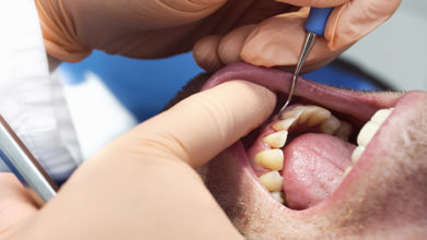 Parodontalna bolezen