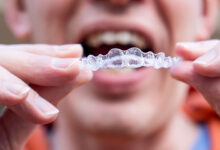 Nevidni zobni aparat