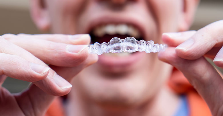 Nevidni zobni aparat